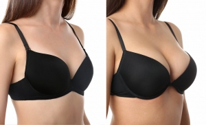 What Does 'Drop and Fluff' Mean After Breast Augmentation?