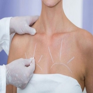 How Breast Lift Surgery Redefines Your Feminine Silhouette